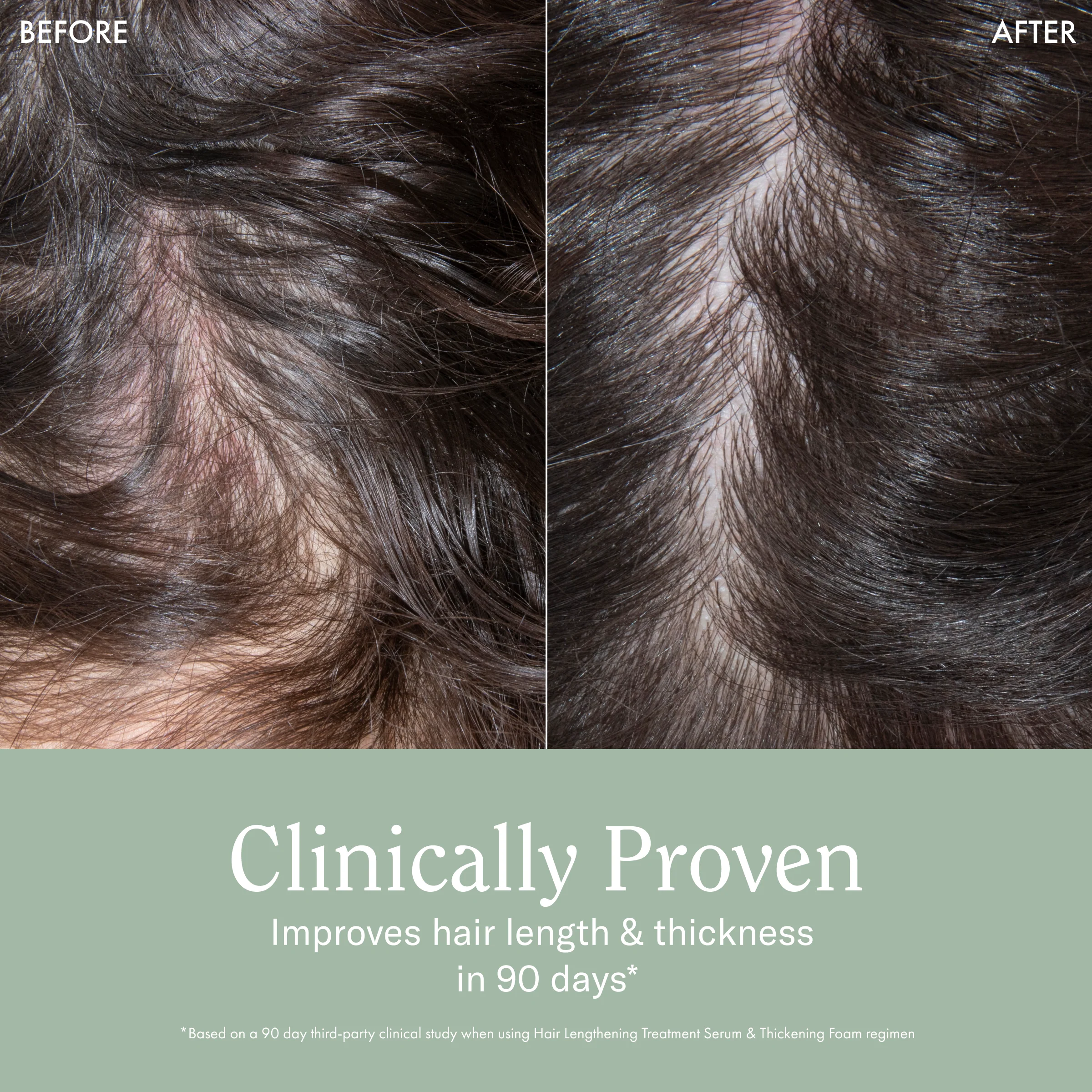 Lengthening Serum + Thickening Foam Bundle - Image 5